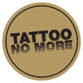 Tattoo no more